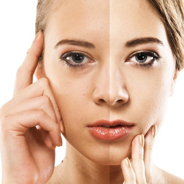 Skin Lightening Peptide