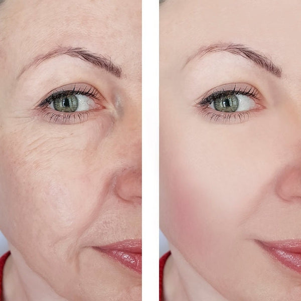 Hyaluronic Acid Liposome TR Time Released